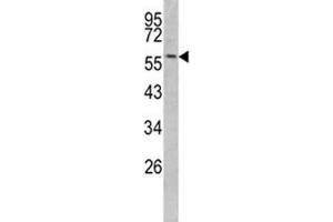 Image no. 3 for anti-Keratin 14 (KRT14) (AA 276-303) antibody (ABIN3031536)