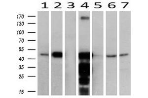 Image no. 4 for anti-Acetyl-CoA Acyltransferase 2 (ACAA2) antibody (ABIN2715630)