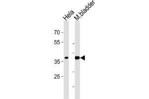 Image no. 2 for anti-Eukaryotic Translation Initiation Factor 3 Subunit H (EIF3H) antibody (ABIN3002723)
