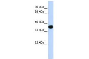 Image no. 1 for anti-T-Cell Leukemia Homeobox 1 (TLX1) (C-Term) antibody (ABIN6744378)