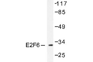 Image no. 1 for anti-E2F Transcription Factor 6 (E2F6) antibody (ABIN265390)