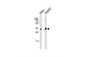 Image no. 2 for anti-Palmitoyl-Protein Thioesterase 1 (PPT1) (AA 1-306) antibody (ABIN1944801)