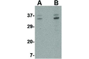 Image no. 1 for anti-ORAI Calcium Release-Activated Calcium Modulator 3 (ORAI3) (C-Term) antibody (ABIN6655875)
