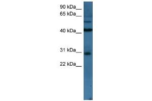 Image no. 1 for anti-T-Cell Leukemia Homeobox 2 (TLX2) (N-Term) antibody (ABIN2781000)