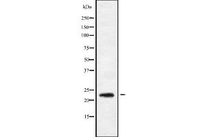 Western blot analysis of RAB9B using HepG2 whole cell lysates