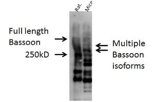 Image no. 2 for anti-Bassoon (BSN) (AA 786-1041) antibody (ABIN863198)