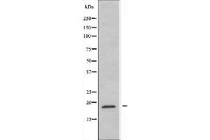 Image no. 1 for anti-Ribosomal Protein L12 (RPL12) (C-Term) antibody (ABIN6258526)