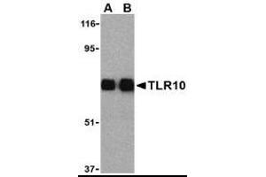 Image no. 1 for anti-Toll-Like Receptor 10 (TLR10) (Internal Domain) antibody (ABIN307009)