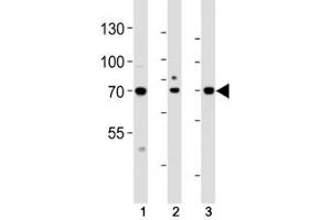 Image no. 5 for anti-Activating Transcription Factor 6 beta (ATF6B) (AA 560-589) antibody (ABIN3029852)