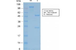 Image no. 4 for anti-Neurofilament, Heavy Polypeptide (NEFH) antibody (ABIN6940185)