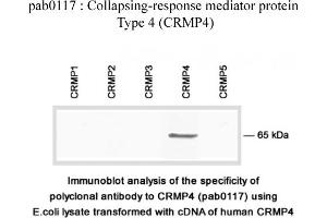 Image no. 2 for anti-Dihydropyrimidinase-Like 3 (DPYSL3) (C-Term) antibody (ABIN347042)