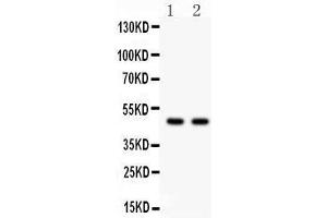 Image no. 1 for anti-Prostate Tumor Overexpressed 1 (PTOV1) (AA 385-414), (C-Term) antibody (ABIN3042495)