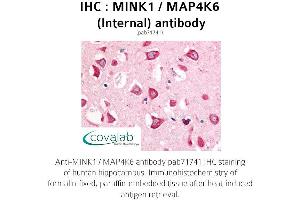 Image no. 2 for anti-Misshapen-Like Kinase 1 (MINK1) (Internal Region) antibody (ABIN1736952)
