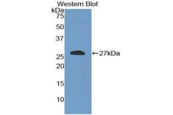 anti-SHC (Src Homology 2 Domain Containing) Transforming Protein 2 (SHC2) (AA 98-302) antibody
