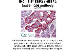Image no. 1 for anti-Eukaryotic Translation Initiation Factor 4E Binding Protein 2 (EIF4EBP2) (AA 99-120) antibody (ABIN1733956)