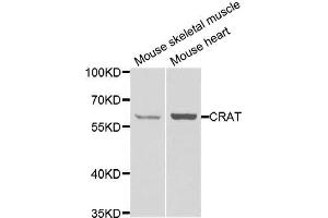Image no. 1 for anti-Carnitine O-Acetyltransferase (CRAT) antibody (ABIN2561991)
