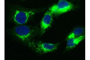 Image no. 1 for anti-alpha-2-HS-Glycoprotein (AHSG) (AA 1-367) antibody (ABIN1996377)
