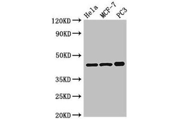 PRKAR2A antibody  (Regulatory Subunit)