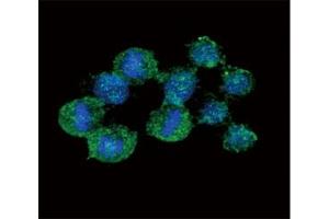 Image no. 5 for anti-Interleukin 8 (IL8) (AA 72-99) antibody (ABIN3031487)