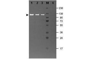Image no. 1 for Hamster Complement (Lyophilized) With Diluent (ABIN925155)