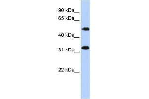 Image no. 1 for anti-Chromosome 6 Open Reading Frame 150 (C6orf150) (Middle Region) antibody (ABIN2785007)