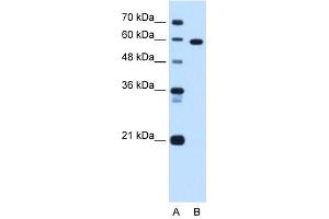 Image no. 3 for anti-T-Box 15 (TBX15) (C-Term) antibody (ABIN925971)
