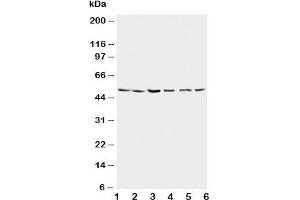 Image no. 3 for anti-Presenilin 2 (Alzheimer Disease 4) (PSEN2) (N-Term) antibody (ABIN3032302)