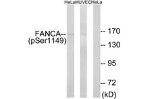 Western blot analysis of extracts from HeLa cells treated with IGF 100ng/ml 10' and HuvEc cells treated with EGF 200ng/ml 30', using FANCA (Phospho-Ser1149) Antibody.