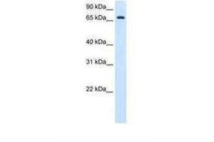 Image no. 2 for anti-Histidine Ammonia-Lyase (HAL) (C-Term) antibody (ABIN320973)