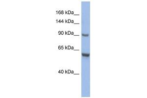 Image no. 1 for anti-CDKN1A Interacting Zinc Finger Protein 1 (CIZ1) (Middle Region) antibody (ABIN2775710)