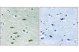 Image no. 4 for anti-Insulin-Like Growth Factor 1 Receptor (IGF1R) (Tyr1346) antibody (ABIN1848190)