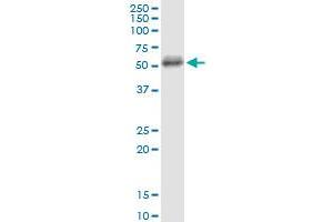 Image no. 2 for anti-CD5 (CD5) (AA 403-495) antibody (ABIN947650)