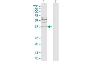 Image no. 1 for anti-DNA Repair Protein RAD51 Homolog 3 (RAD51C) (AA 1-376) antibody (ABIN519609)