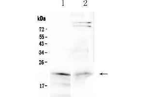Image no. 3 for anti-Cytoglobin (CYGB) (AA 1-190) antibody (ABIN5518753)
