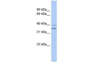 Image no. 1 for anti-Guanine Nucleotide Binding Protein (G Protein), Q Polypeptide (GNAQ) (N-Term) antibody (ABIN2785811)