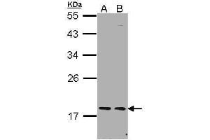 Image no. 1 for anti-PEST Proteolytic Signal Containing Nuclear Protein (PCNP) (N-Term) antibody (ABIN2856840)
