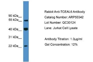 Image no. 2 for anti-Transcription Elongation Factor A (SII)-Like 6 (TCEAL6) (C-Term) antibody (ABIN2784147)