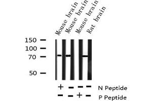 Image no. 4 for anti-Forkhead Box O1 (FOXO1) (pSer256) antibody (ABIN6255137)