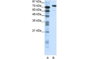 Image no. 2 for anti-SATB Homeobox 1 (SATB1) (C-Term) antibody (ABIN2780457)