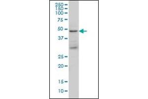 Image no. 1 for anti-Tumor Susceptibility Gene 101 (TSG101) antibody (ABIN781822)