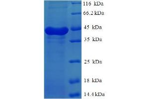 Calpain, Small Subunit 1 (CAPNS1) (AA 1-268), (full length) protein (His-SUMO Tag)