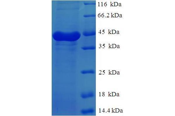 Calpain, Small Subunit 1 (CAPNS1) (AA 1-268), (full length) protein (His-SUMO Tag)