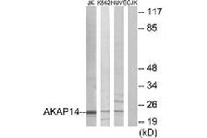 Image no. 1 for anti-A Kinase (PRKA) Anchor Protein 14 (AKAP14) (AA 1-50) antibody (ABIN1533981)