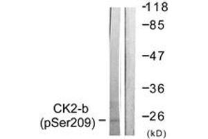 Western blot analysis of extracts from HuvEc cells, using CKII-beta (Phospho-Ser209) Antibody.