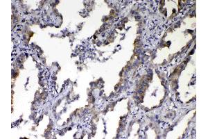 Image no. 2 for anti-Nephroblastoma Overexpressed (NOV) (AA 334-357), (C-Term) antibody (ABIN5518938)