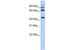 Image no. 1 for anti-Dipeptidylpeptidase 10 (DPP10) (Middle Region) antibody (ABIN635073)