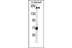 Image no. 2 for anti-GRIP and Coiled-Coil Domain Containing 2 (GCC2) (AA 1548-1617), (C-Term) antibody (ABIN952473)