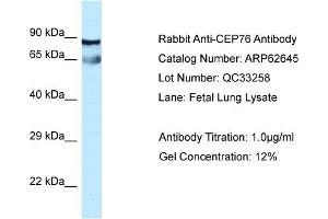 Image no. 1 for anti-Centrosomal Protein 76kDa (Cep76) (Middle Region) antibody (ABIN2789198)