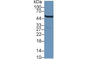 Image no. 1 for anti-Aldehyde Dehydrogenase 9 Family, Member A1 (ALDH9A1) (AA 322-494) antibody (ABIN1866626)