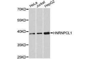Image no. 1 for anti-Heterogeneous Nuclear Ribonucleoprotein C-Like 1 (HNRNPCL1) antibody (ABIN4903953)